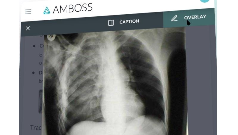 đối tượng sử dụng amboss